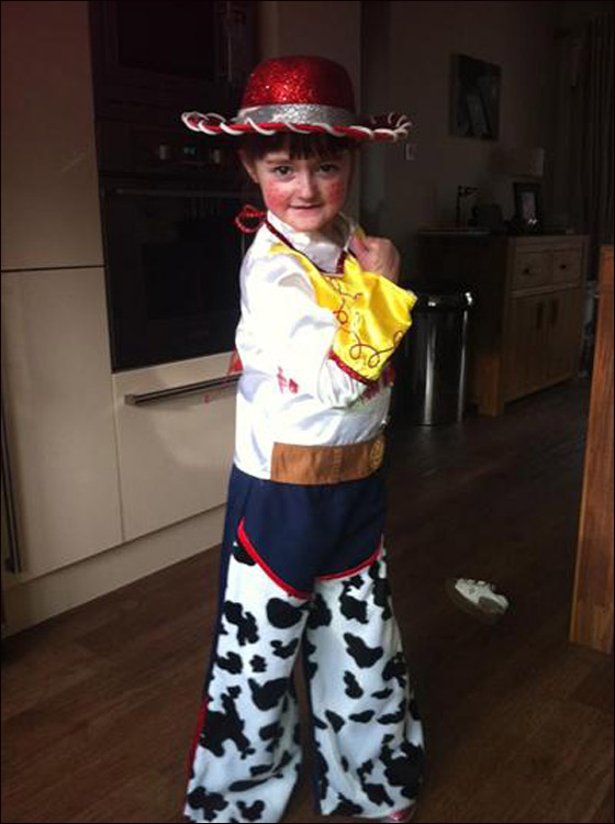 طفلة تحارب الموت يوميا وتعاني من مرض يقشر جلدها عند لمسه! صورة رقم 8