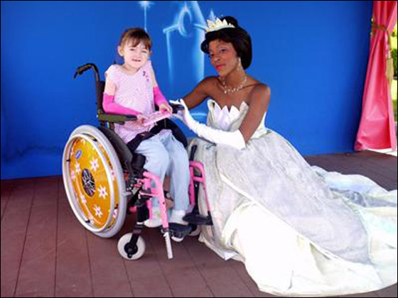 طفلة تحارب الموت يوميا وتعاني من مرض يقشر جلدها عند لمسه! صورة رقم 6