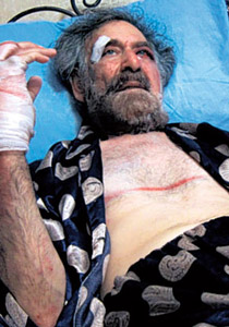 الشبيحة يعتدون والدبوماسيون يتضامنون وفرزات يواصل الرسم! صورة رقم 1