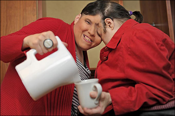 بعيد ميلادهما الـ50.. اكبر توأمان ملتصقان يكشفان اسرارهما النوعية صورة رقم 8