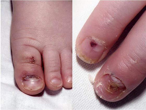  قاضٍ بريطاني يحرم أمًّا من الإنجاب بسبب تنكيلها بطفلتها!  صورة رقم 2