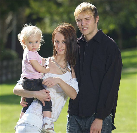 اصيبت بالعمى في احدى عينيها بعد تناولها جرعات هائلة من الكحول!! صورة رقم 2