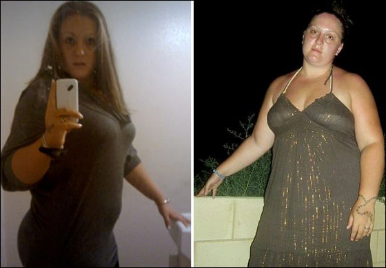 اكتشفت انها حامل بعد خضوعها لعملية تقصير معدة وقتلت طفلتها!! صورة رقم 2