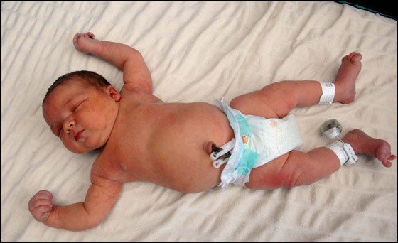 بريطانية تضع مولودا يعادل وزنه وزن مولودين طبيعيين!!  صورة رقم 4