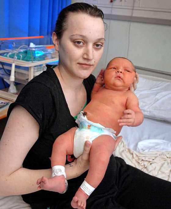 بريطانية تضع مولودا يعادل وزنه وزن مولودين طبيعيين!!  صورة رقم 2