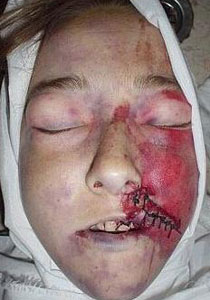 تفاصيل حياة راشيل كوري حتى لحظة دهسها بجرافة اسرائيلية صورة رقم 1