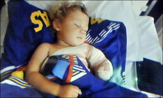 طفل يفقد ذراعه اليسرى عقب دخوله الى الغسالة وهي تعمل!  صورة رقم 5