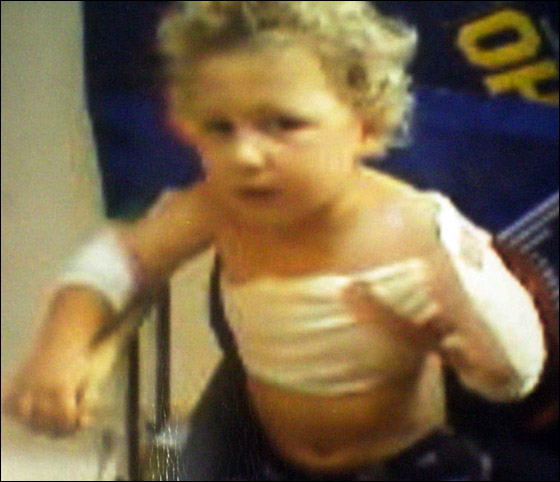 طفل يفقد ذراعه اليسرى عقب دخوله الى الغسالة وهي تعمل!  صورة رقم 4