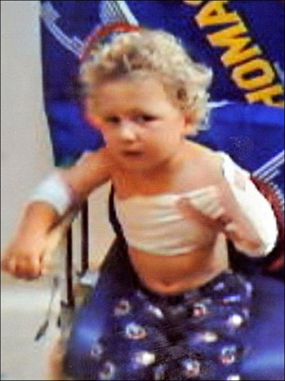 طفل يفقد ذراعه اليسرى عقب دخوله الى الغسالة وهي تعمل!  صورة رقم 6