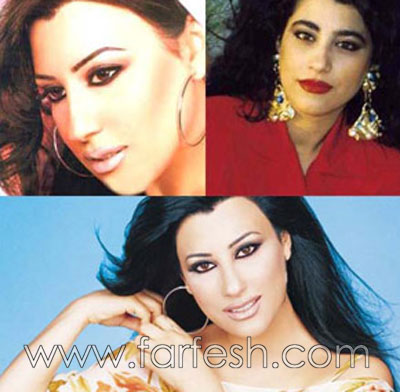 فضائح الصور: الفنانات قبل وبعد عمليات التجميل!  صورة رقم 5