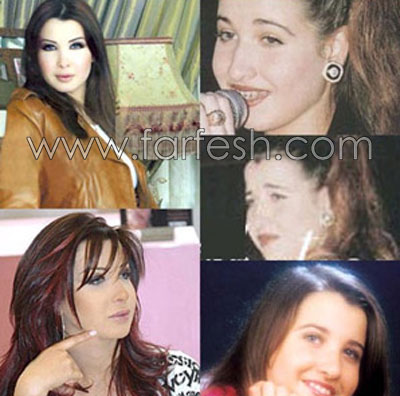 فضائح الصور: الفنانات قبل وبعد عمليات التجميل!  صورة رقم 10