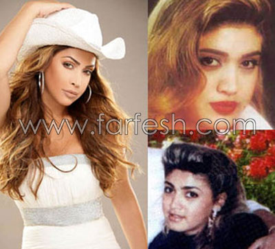 فضائح الصور: الفنانات قبل وبعد عمليات التجميل!  صورة رقم 21