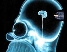  شاب يمارس حياته الطبيعية وفي دماغه عيار ناري! صورة رقم 1