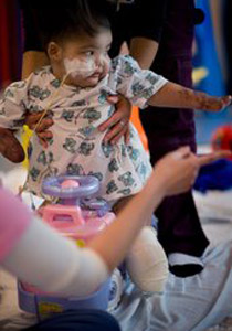 اهمال الاطباء ومماطلة العلاج أدى الى إعاقة طفلة وبتر اطرافها!! صورة رقم 1