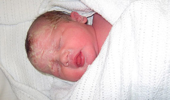 ابلغها الأطباء ان طفلتها توفيت بداخلها وتبين لاحقا انها حية  صورة رقم 4