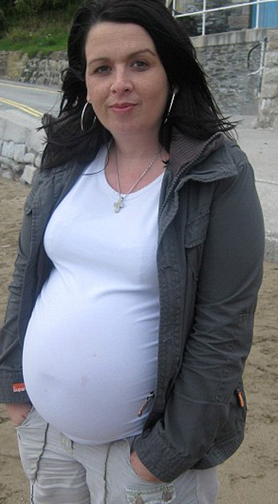 ابلغها الأطباء ان طفلتها توفيت بداخلها وتبين لاحقا انها حية  صورة رقم 5