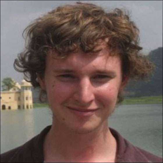 بريطاني يتماثل للشفاء بعد ان تحطمت جمجمته لـ 30 قطعة!!  صورة رقم 4