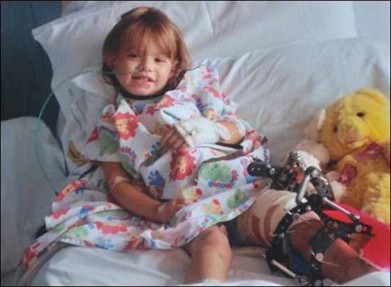 معجزة: طفلة بريطانية تتعافى بشكل عجيب بعد أن صدمها قطار!! صورة رقم 3