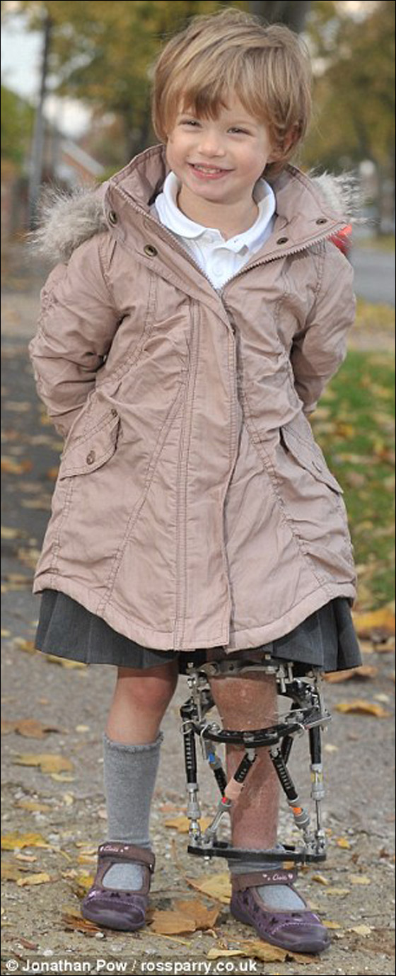 معجزة: طفلة بريطانية تتعافى بشكل عجيب بعد أن صدمها قطار!! صورة رقم 2