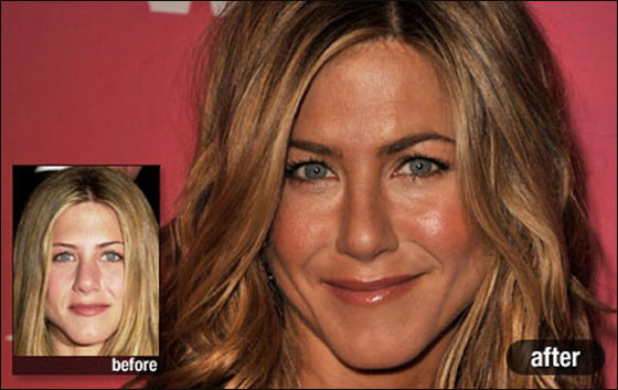 بالصور.. أشهر نجمات هوليوود قبل وبعد عمليات التجميل!!  صورة رقم 1