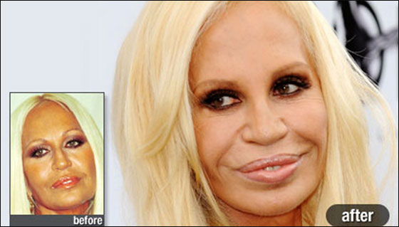 بالصور.. أشهر نجمات هوليوود قبل وبعد عمليات التجميل!!  صورة رقم 8