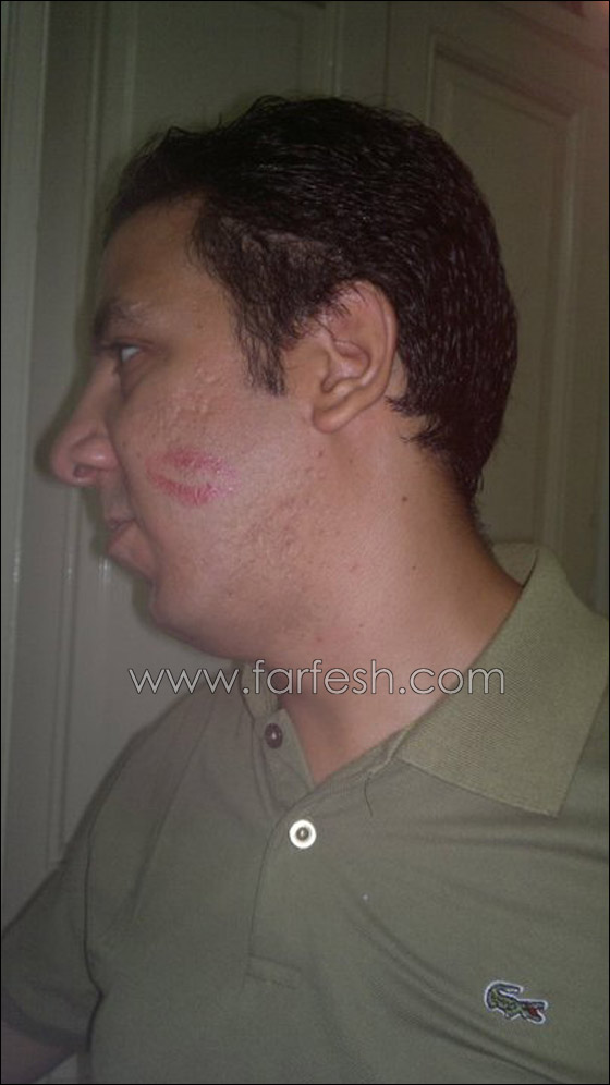 الفرق بين مصرية نشرت صورها الغير محتشمه واخرى كشفت عن عذريتها! صورة رقم 33