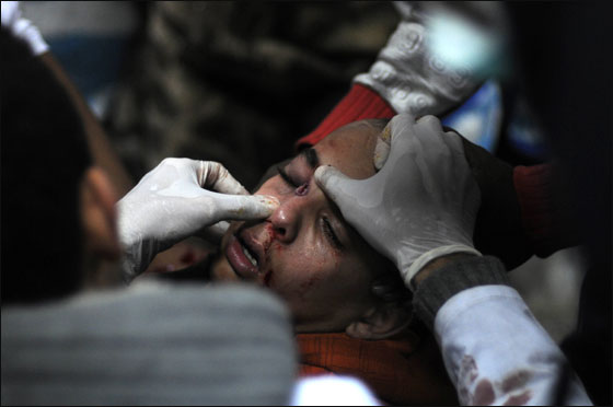 بعد 33 قتيلا.. ميدان التحرير يستعد لمليونية تربك الحكومة المصرية!! صورة رقم 8