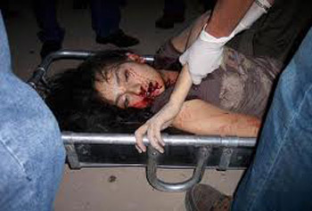 هل حقا قتلت مخلع الملابسة 