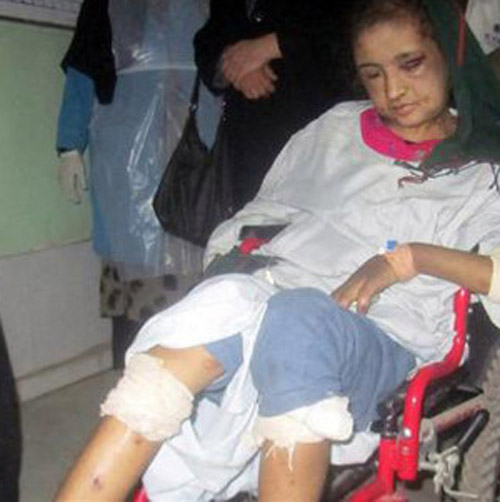 احتجاز مراهقة افغانية لمدة 6 اشهر لرفضها ممارسة الرذيلة! صورة رقم 1