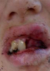 لرفضها الزواج منه.. فتاة تتعرض لاعتداء وحشي من رجل اعمال صورة رقم 2