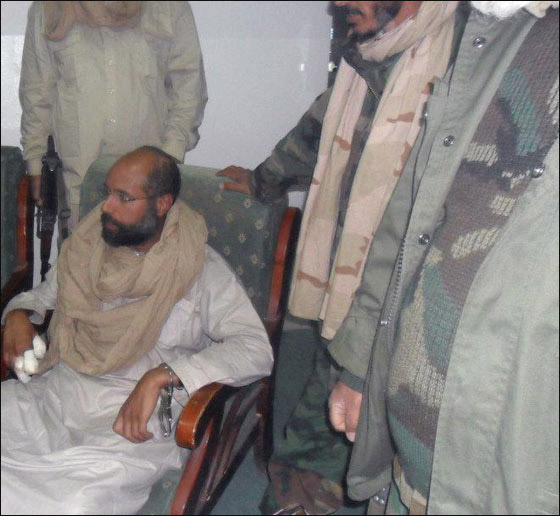 سيف الاسلاف يفقد اصبعا جديدا من يده المصابة بالغرغرينا! صورة رقم 1