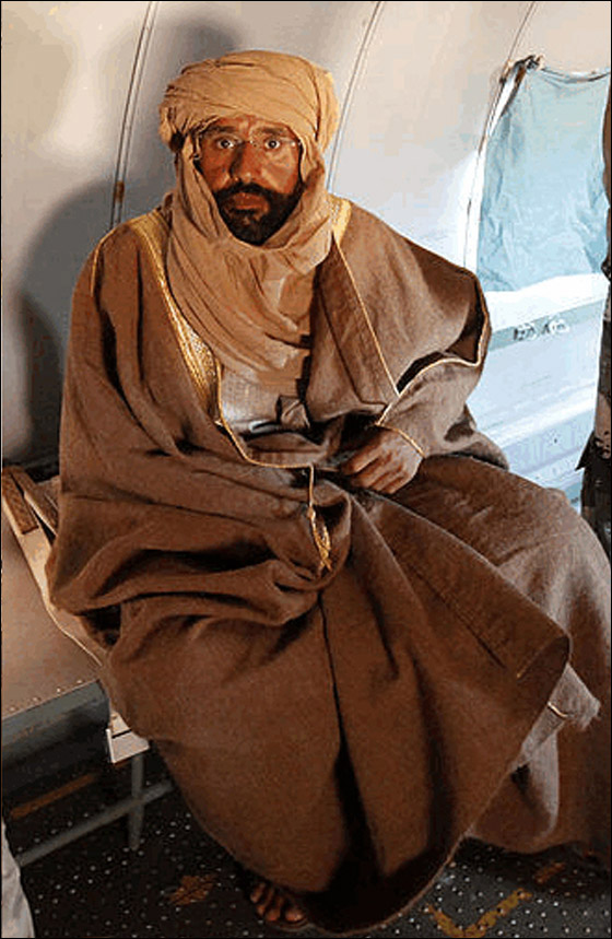 سيف الاسلاف يفقد اصبعا جديدا من يده المصابة بالغرغرينا! صورة رقم 4