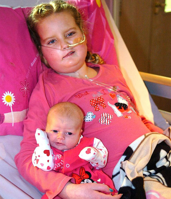 سرّعت ولادتها ليتسنى لابنتها المريضة رؤية شقيقتها قبل موتها! صورة رقم 2