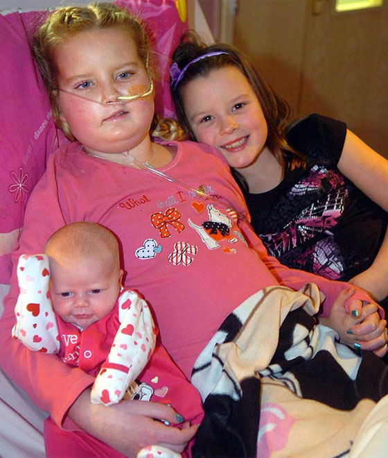 سرّعت ولادتها ليتسنى لابنتها المريضة رؤية شقيقتها قبل موتها! صورة رقم 3