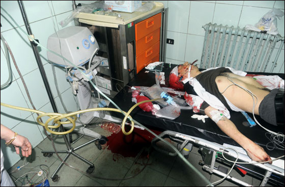 سوريا: سقوط 35 قتيلاً في مظاهرات للمطالبة بإنهاء حكم الأسد صورة رقم 12