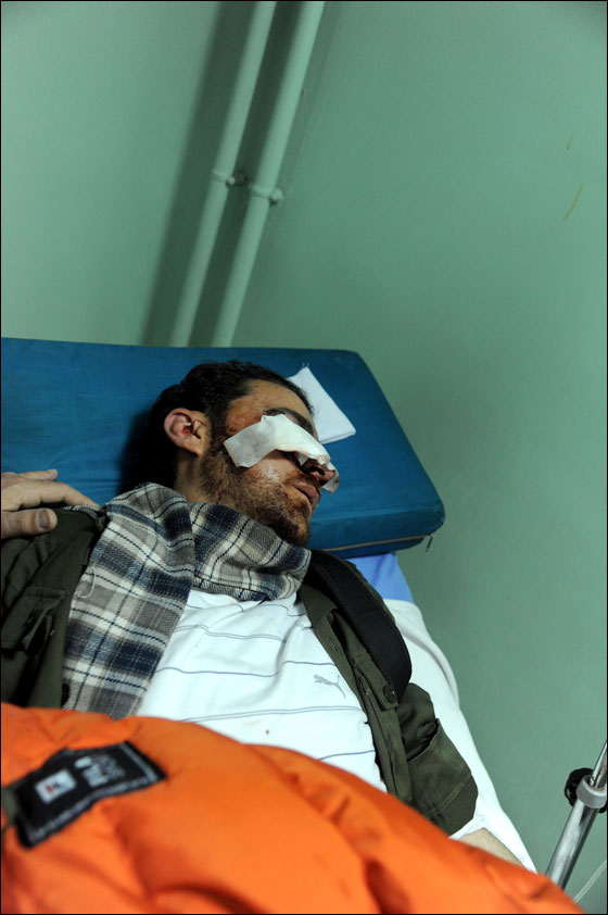 سوريا: سقوط 35 قتيلاً في مظاهرات للمطالبة بإنهاء حكم الأسد صورة رقم 14