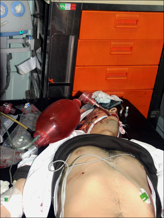 سوريا: سقوط 35 قتيلاً في مظاهرات للمطالبة بإنهاء حكم الأسد صورة رقم 20