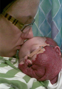 مخدر عجيب ينقذ حياة طفلة مشوهة بعد ان كادت تفارق الحياة!! صورة رقم 1