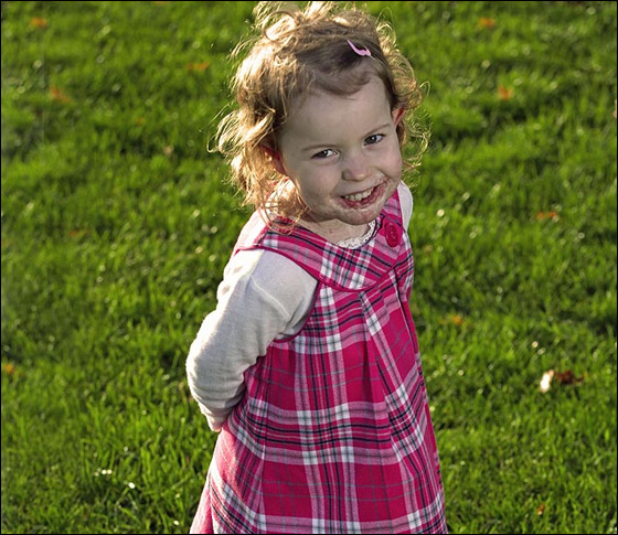 مخدر عجيب ينقذ حياة طفلة مشوهة بعد ان كادت تفارق الحياة!! صورة رقم 2