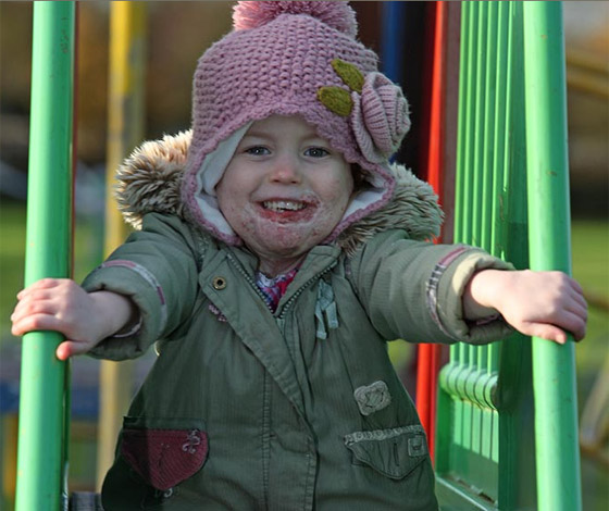 مخدر عجيب ينقذ حياة طفلة مشوهة بعد ان كادت تفارق الحياة!! صورة رقم 6