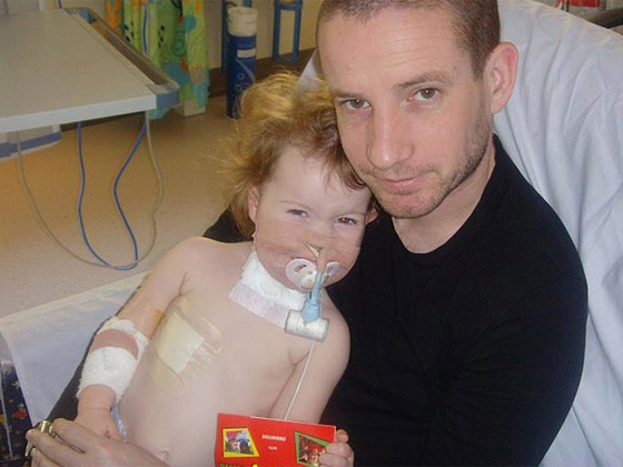 مخدر عجيب ينقذ حياة طفلة مشوهة بعد ان كادت تفارق الحياة!! صورة رقم 5