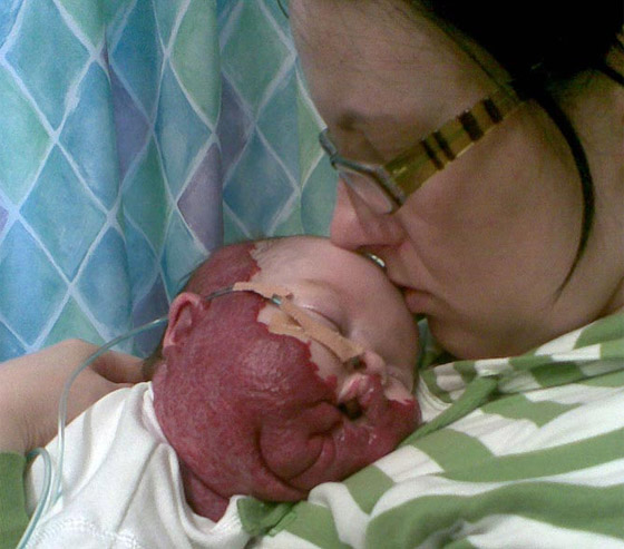 مخدر عجيب ينقذ حياة طفلة مشوهة بعد ان كادت تفارق الحياة!! صورة رقم 4