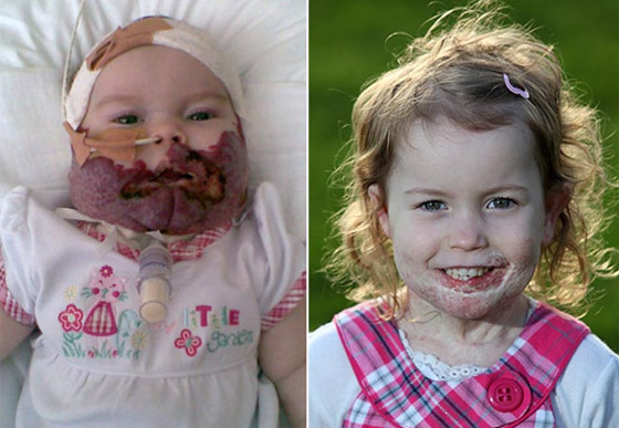 مخدر عجيب ينقذ حياة طفلة مشوهة بعد ان كادت تفارق الحياة!! صورة رقم 7