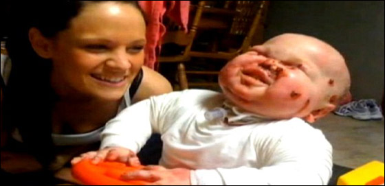 وفاة طفل بين ذراعي امه بعد صراع مع مرض جلد تركه مشوها!  صورة رقم 2