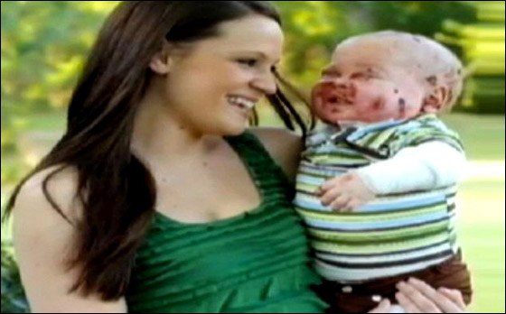وفاة طفل بين ذراعي امه بعد صراع مع مرض جلد تركه مشوها!  صورة رقم 5