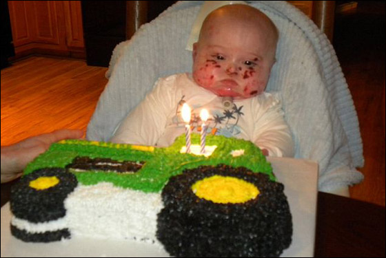 وفاة طفل بين ذراعي امه بعد صراع مع مرض جلد تركه مشوها!  صورة رقم 4