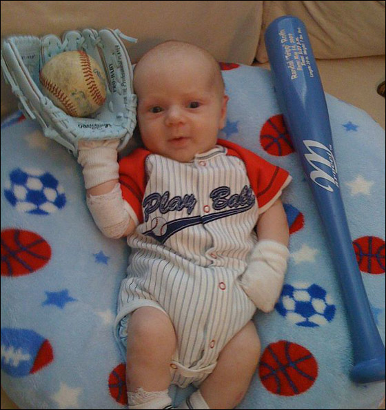 وفاة طفل بين ذراعي امه بعد صراع مع مرض جلد تركه مشوها!  صورة رقم 17