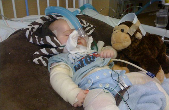 وفاة طفل بين ذراعي امه بعد صراع مع مرض جلد تركه مشوها!  صورة رقم 7