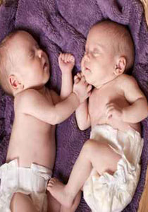 توامان بحالة حرجة وشكوك حول تعرضهما للتنكيل من قبل والديهما! صورة رقم 1