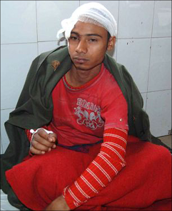 امرأة هندية حامل تنجو بأعجوبة من بين انياب نمر مفترس!  صورة رقم 4